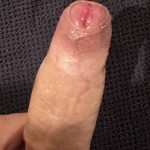 UntouchedForeskin