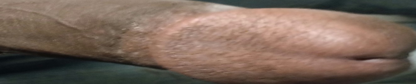 DickMeat