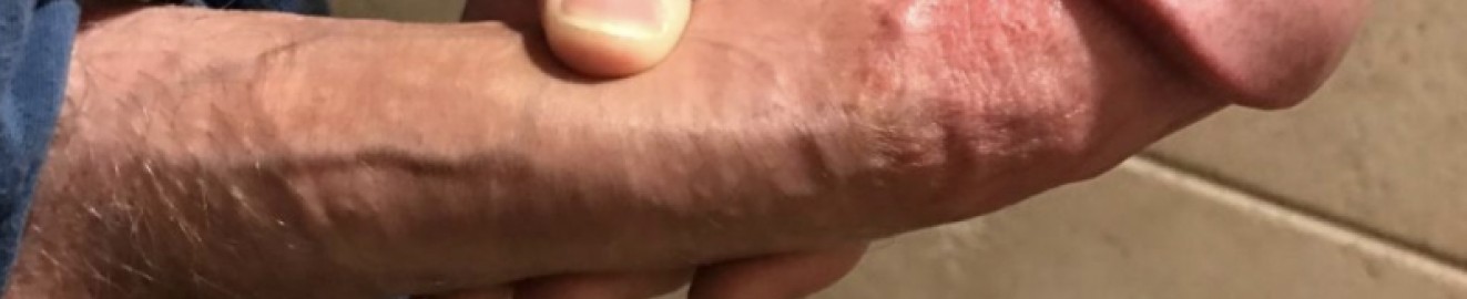 The Missouri Mule Dick