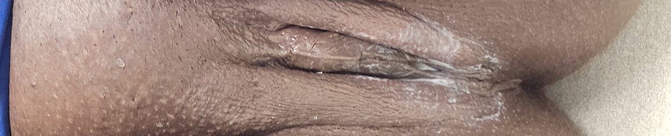 ChocolateBunny69