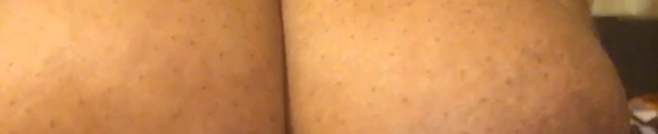 anonymtitty