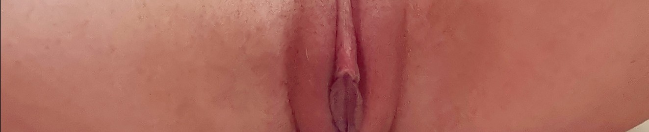 Canaerotico