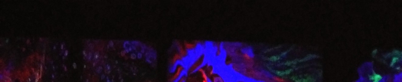 UV baby