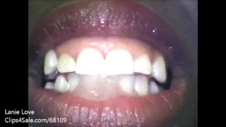 Lanie Loves endoscopic