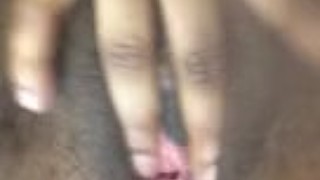 Kiss It