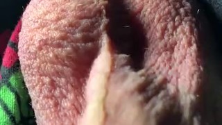 Moving testicles