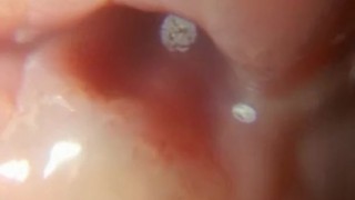head and foreskin superzoom