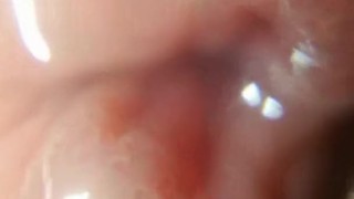 head and foreskin superzoom