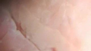 head and foreskin superzoom