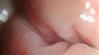 head and foreskin superzoom