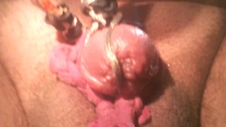 Painful electro torture my tiny penis head