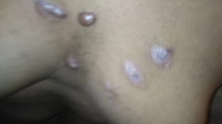 Moobs moobs