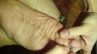 needle on my soles & between toes