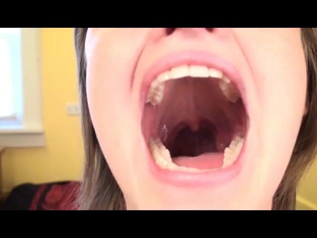 Mouth Wide Open - Open Wide Mouth - Free Porn Videos - YouPorn