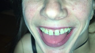 Cum play with retainer.