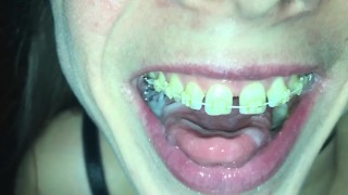 Cum play with retainer.