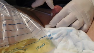 Sounding (1cm) and finger play after remove catheter