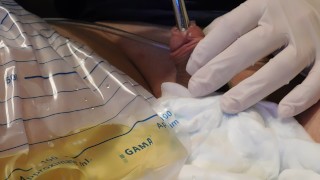 Sounding (1cm) and finger play after remove catheter