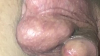 Young Furry ass prostate massage