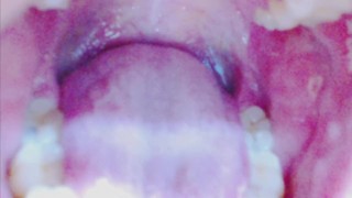 Tongue, Tonsils, and Throat Examination