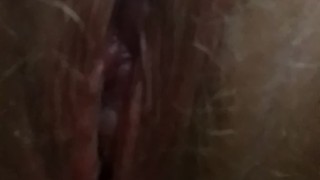 Blaire peeing post op