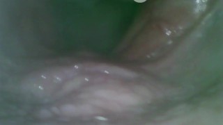 The camera inside the pussy emoves the penetration of the penis.