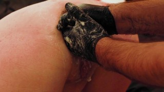 Analdehnung und Fistingtraining für die Frau