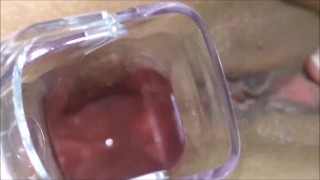 Watch anal inside using Speculum Anus close-up