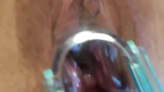 Checking out my wife's cervix with a speculum