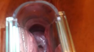 Checking out my wife's cervix with a speculum