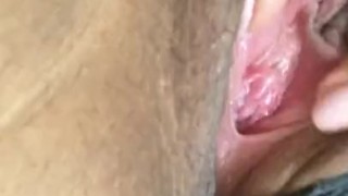 Pussy hair