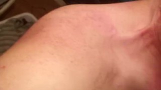 chewed apart aftermath biting fetish