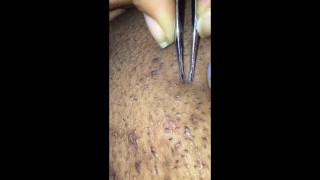Plump Pubic Pussy Pluck