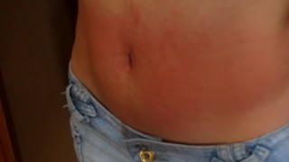 Paula's red belly after slapping and biting Fantasy of Paula