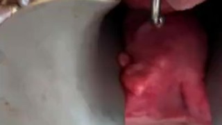 Double speculum 1