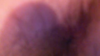 CLOSE UP Endoscope Asshole Hairy MILF Mature