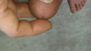 A thread appeared from an urethral opening when excited