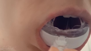 Spitting out a large amount of saliva after Teeth Whitening