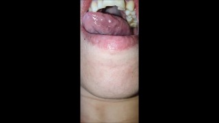 Mouth and tongue check dry - demo