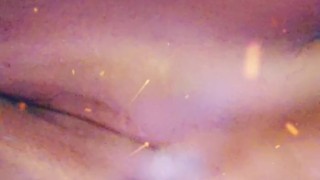 Horny while recovering from surgery. can't fuck for 5 more week and horny