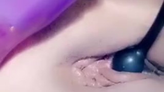 Inflation catheter inside my pee hole and pull it out