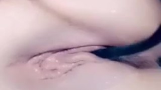 Inflation catheter inside my pee hole and pull it out
