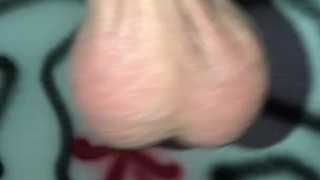 Low hanging balls Droopy or Drippy balls Testicles