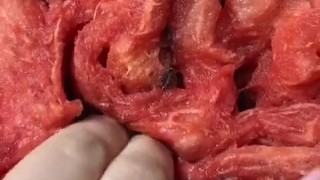 Fisting a Watermelon