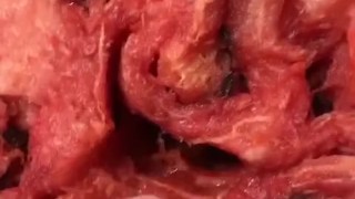Fisting a Watermelon