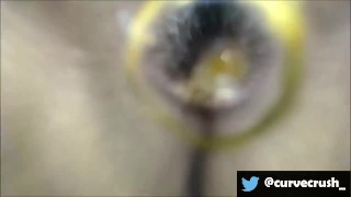 Bladder Measure