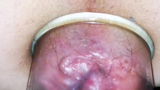 Anal pump and rosebud