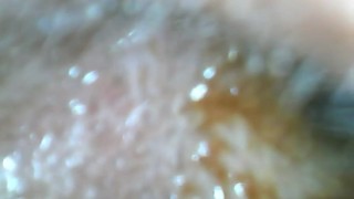 Looking Inside a Dirty Ear