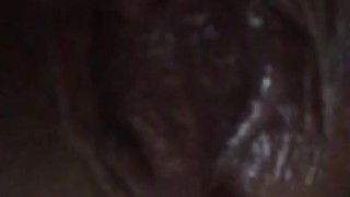 Exposed Clit