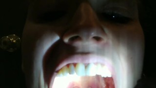 Tongue and Throat Exam (with and without flashlight)